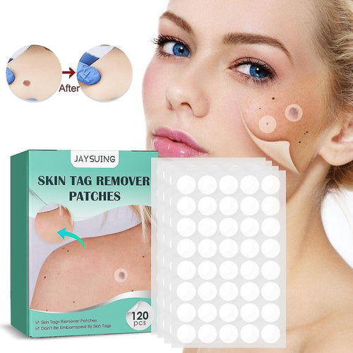 Mole Removal Patches